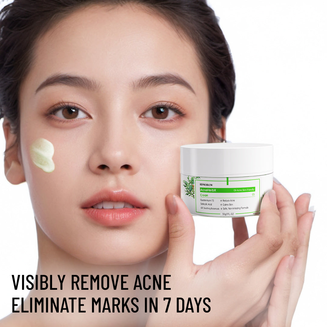 AcneHerbX Cream